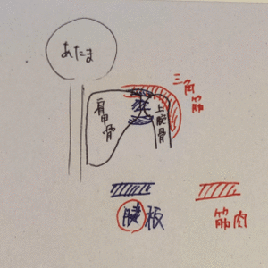 【症状】肩関節周囲炎。中では何が...？